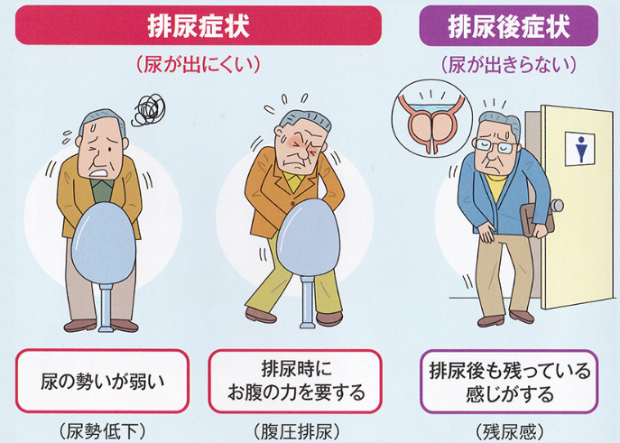 日本泌尿器科学会 専門医による日帰りの前立腺肥大症治療